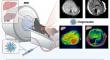 Non-invasive diagnosis of liver fibrosis via MRI using targeted gadolinium-based nanoparticles.