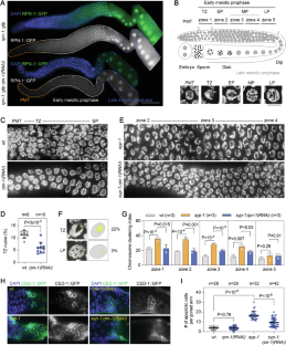 A chromosome-coupled ubiquitin-proteasome pathway is required for meiotic surveillance