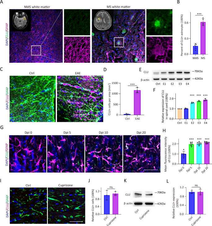 Astrocyte-derived clusterin disrupts glial physiology to obstruct remyelination in mouse models of demyelinating diseases