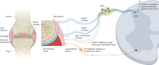 An interdisciplinary perspective on peripheral drivers of pain in rheumatoid arthritis