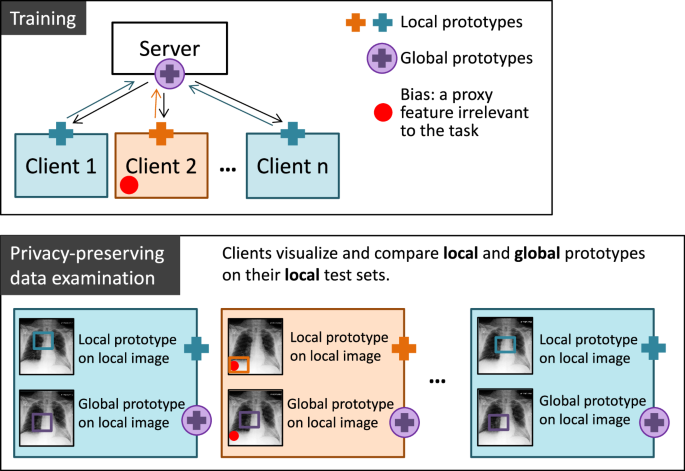 MyThisYourThat for interpretable identification of systematic bias in federated learning for biomedical images