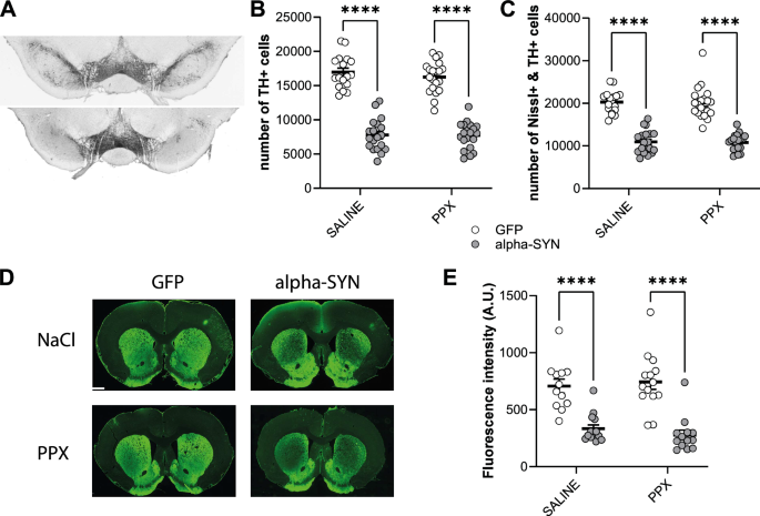 Alpha-synuclein-induced nigrostriatal degeneration and pramipexole treatment disrupt frontostriatal plasticity