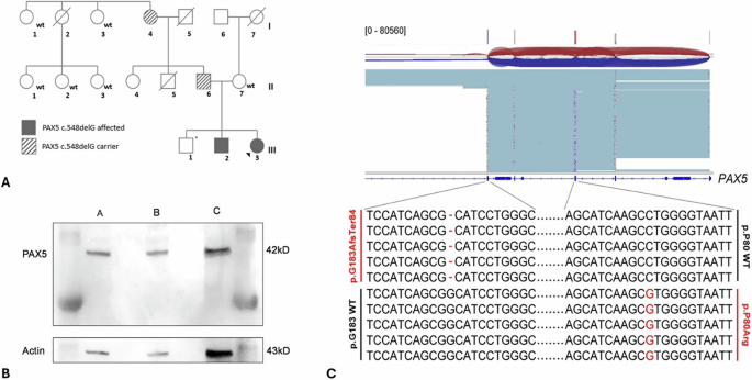 Diverse mechanisms of leukemogenesis associated with PAX5 germline mutation