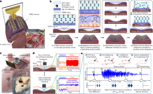 A shape-morphing cortex-adhesive sensor for closed-loop transcranial ultrasound neurostimulation