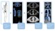 EANM position paper on challenges and opportunities of full-ring 360° CZT bone imaging: it’s time to let go of planar whole-body bone imaging