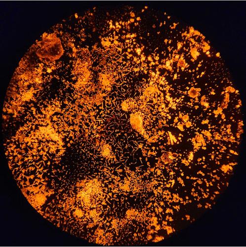 Electroprecipitating the Sulfate Radical Anion Amplifies Electrochemiluminescence in Space and Time