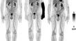 Long axial field-of-view PET imaging of intraarterial 2-[18F]FDG injection