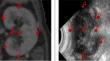 Global registration of kidneys in 3D ultrasound and CT images.