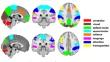 Functional connectivity of the pediatric brain.