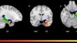 Family Members’ Reward-Based Activation in Response to an AUD Love-One