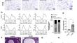 Transcription repression of estrogen receptor alpha by ghrelin/Gq/11/YAP signaling in granulosa cells promotes polycystic ovary syndrome.