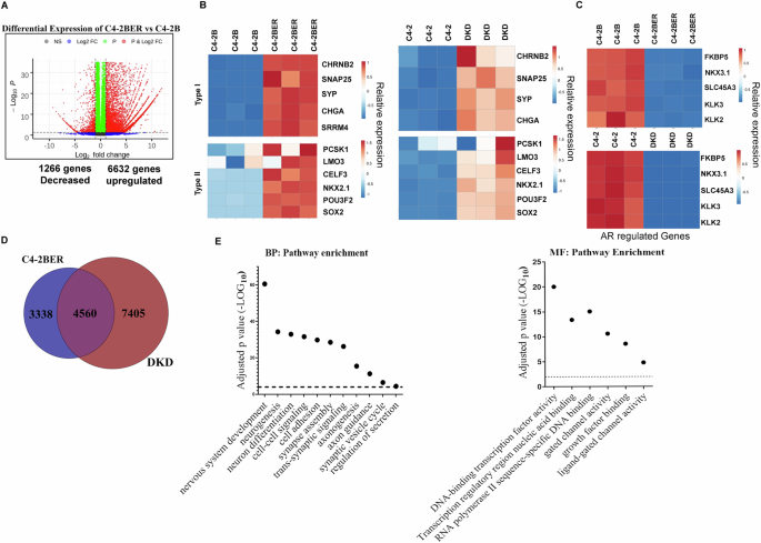 Understanding the function of Pax5 in development of docetaxel-resistant neuroendocrine-like prostate cancers.