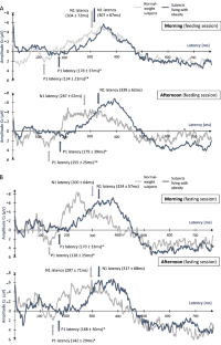 Prolonged latency of the gustatory evoked potentials for sucrose solution in subjects living with obesity compared with normal-weight subjects.