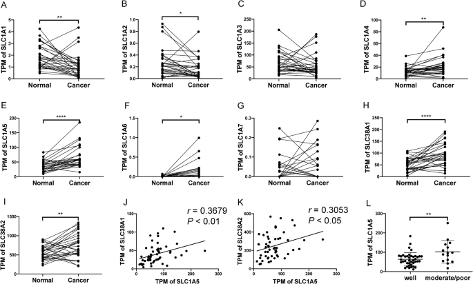 The disruption of NEAT1-miR-125b-5p-SLC1A5 cascade defines the oncogenicity and differential immune profile in head and neck squamous cell carcinoma.