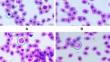 Effect of feeding chitosan and blend of essential organic acids on growth performance, haematological parameters and innate immunity in early aged male layer chicks.