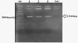 Investigating the interaction of zno nanoparticles with flagellum and fimbriae in multi-drug resistant uropathogenic bacteria encoding fli and fim genes.