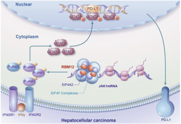 RBM12 drives PD-L1-mediated immune evasion in hepatocellular carcinoma by increasing JAK1 mRNA translation.