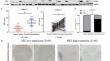 Downregulation of malic enzyme 3 facilitates progression of gastric carcinoma via regulating intracellular oxidative stress and hypoxia-inducible factor-1α stabilization.