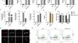 hucMSC-Ex alleviates inflammatory bowel disease in mice by enhancing M2-type macrophage polarization via the METTL3-Slc37a2-YTHDF1 axis