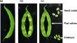 Nucleotide metabolism in common bean pods during seed filling phase reveals the essential role of seed coats