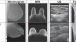 Dual-Tree Complex Wavelet Pooling and Attention-Based Modified U-Net Architecture for Automated Breast Thermogram Segmentation and Classification.