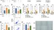 Icariin ameliorates TNF-α/IFN-γ-induced oxidative stress, inflammatory response and apoptosis of human immortalized epidermal cells through the WTAP/SERPINB4 axis.