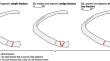 Do we have to redefine type B-fractures of the rib cartilage?