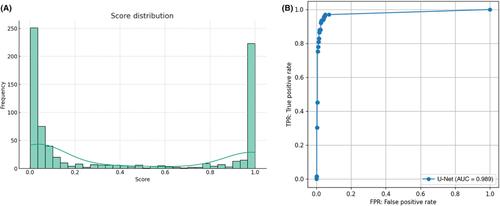 High-quality expert annotations enhance artificial intelligence model accuracy for osteosarcoma X-ray diagnosis