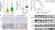 Transcription factor Yin Yang 1 enhances epithelial-mesenchymal transition, migration, and stemness of non-small cell lung cancer cells by targeting sonic hedgehog