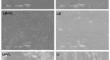 Influence of using different toothpaste during bleaching with violet LED light (405 nm) on the colour and roughness of dental enamel: an in vitro study.