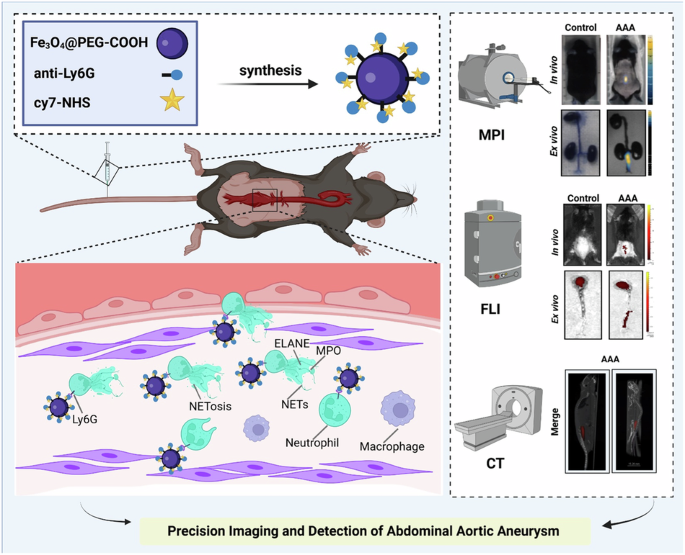 Highly sensitive magnetic particle imaging of abdominal aortic aneurysm NETosis with anti-Ly6G iron oxide nanoparticles.