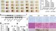 Perihematomal Neurovascular Protection: Blocking HSP90 Reduces Blood Infiltration Associated with Inflammatory Effects Following Intracerebral Hemorrhage in Rates.