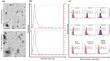 Concentration and Composition of Circulating Adipocyte-Derived Extracellular Vesicles in Patients with Colonic Polyps and Colorectal Cancer