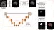 Brain tumor detection and segmentation using deep learning.