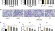 Dendrobine alleviates oleic acid-induced lipid accumulation by inhibiting FOS/METTL14 pathway.