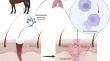 An overview of various stages and morphology of Histoplasma capsulatum var. farciminosum in the horse.