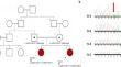 Unraveling neuroimaging insights in developmental epileptic encephalopathy type 25: a comprehensive review of reported cases and a novel SLC13A5 variant.