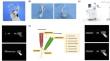 Influence of dental implant clinical experience on the accuracy of robot-assisted immediate implant placement: an in vitro study.