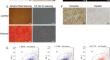 Cyclic tensile stress promotes osteogenic differentiation via upregulation of Piezo1 in human dental follicle stem cells.