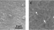 Mechanical properties of polycaprolactone bone scaffolds reinforced with carbon nanotube-modified tricalcium phosphate