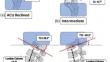 Expanded Combined Loading Injury Criterion for the Human Lumbar Spine Under Dynamic Compression