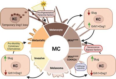 Dangerous liaisons: Loss of keratinocyte control over melanocytes in melanomagenesis.