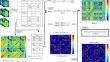 Differences in Topography of Individual Amyloid Brain Networks by Amyloid PET Images in Healthy Control, Mild Cognitive Impairment, and Alzheimer's Disease.