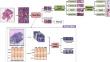 Predicting breast cancer molecular subtypes from H &E-stained histopathological images using a spatial-transcriptomics-based patch filter