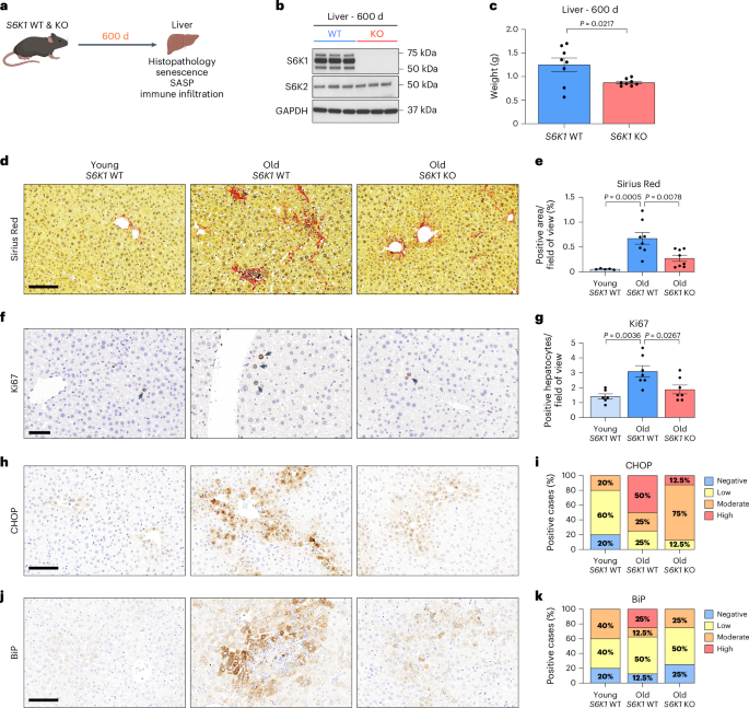 Ribosomal S6 kinase 1 regulates inflammaging via the senescence secretome.