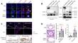 Heme oxygenase-1 binds gasdermin D to inhibit airway epithelium pyroptosis in allergic asthma.