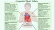 Pharmacological management of heart failure in adults with congenital heart disease.