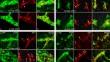 Somatostatin-immunoreactive neurons of the rat gut during the development.