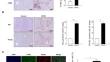 Core-fucose-specific Pholiota squarrosa lectin decreased hepatic inflammatory macrophage infiltration in steatohepatitis mice.