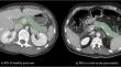 Radiomics and 256-slice-dual-energy CT in the automated diagnosis of mild acute pancreatitis: the innovation of formal methods and high-resolution CT.